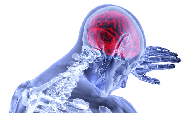 Migraine – More than ‘just a headache’